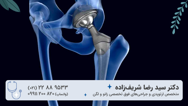 پروتز لگن چیست و چه کاربردی دارد