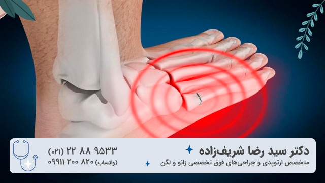 شکستگی استرسی در فشارهای تکرارشونده