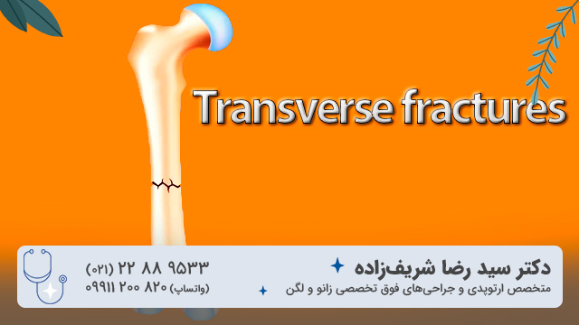 شکستگی استخوانی عرضی (Transverse fractures)