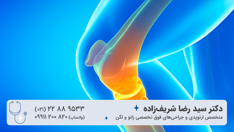 آرتروز و علائم آرتروز زانو چیست