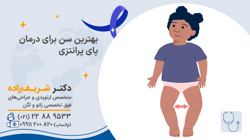 بهترین سن برای درمان پای پرانتزی