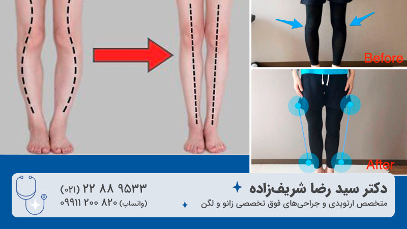 از کجا بفهمیم پا پرانتزی هستیم؟