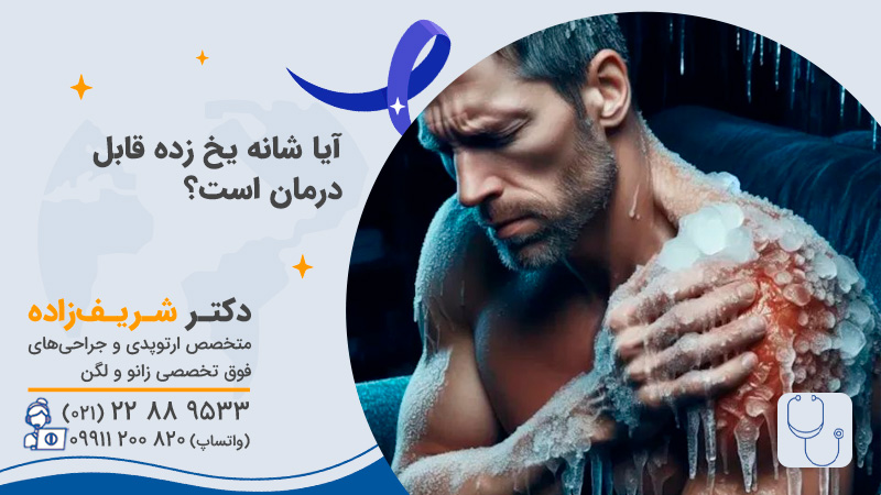 آیا شانه یخ زده قابل درمان است؟