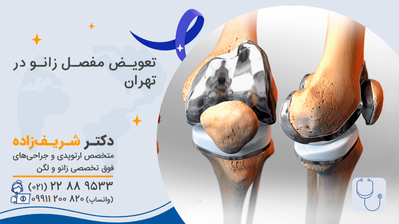 تعویض مفصل زانو در تهران با دکتر شریفزاده: تجربه، مهارت و مراقبت مطمئن