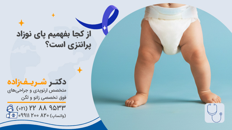 از کجا بفهمیم پای نوزاد پرانتزی است
