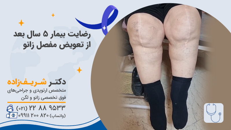 آیا اضافه وزن بر نتیجه جراحی تعویض مفصل زانو تاثیر میگذارد