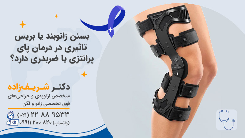 زانوبند برای پای پرانتزی و ضربدری