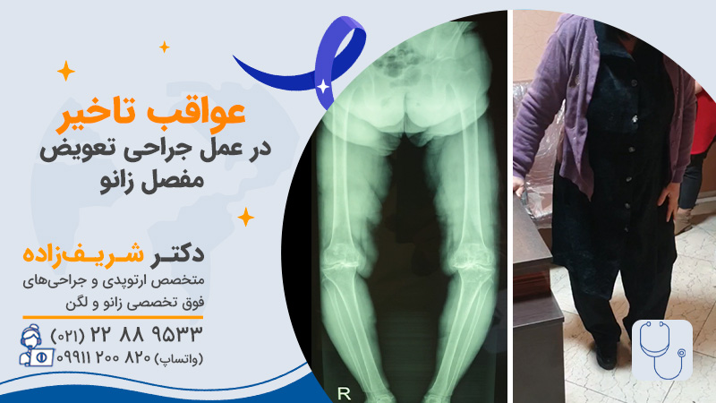 عواقب خطرناک تاخیر در عمل جراحی تعویض مفصل زانو