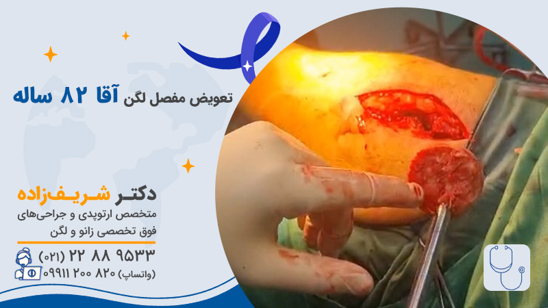 شکستگی استخوان ران در سالمندان