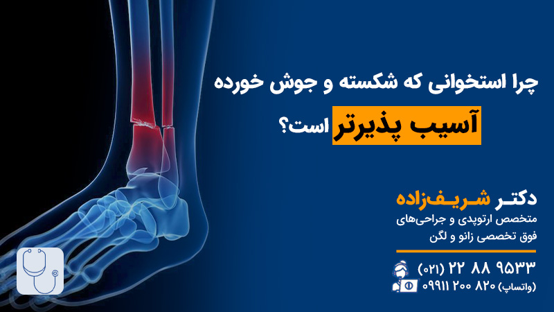 چرا استخوانی که یک بار شکسته شده و جوش خورده آسیبپذیرتر است