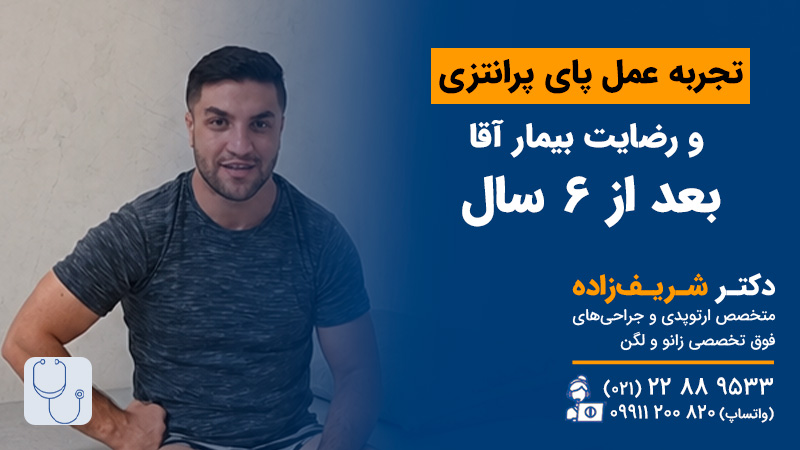 تجربه عمل پای پرانتزی
