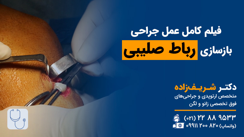 فیلم جراحی رباط صلیبی زانو