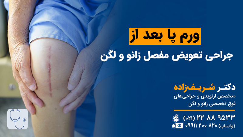 ورم پا بعد از جراحی تعویض مفصل زانو