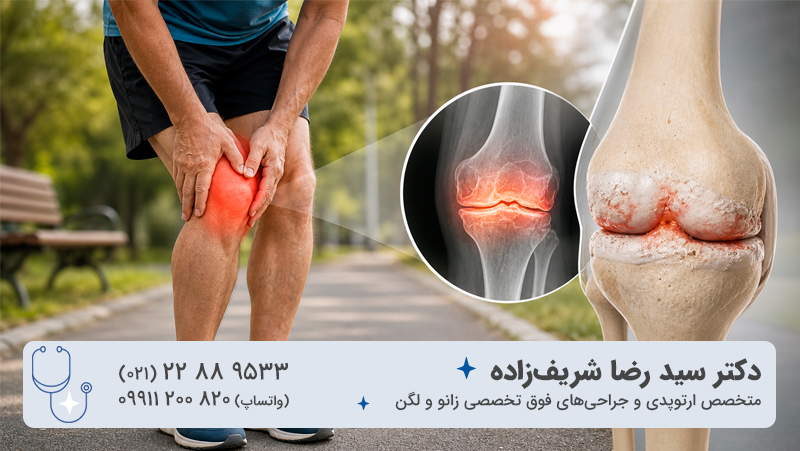 آرتروز زانو؛ درد ناشی از فرسایش تدریجی مفصل