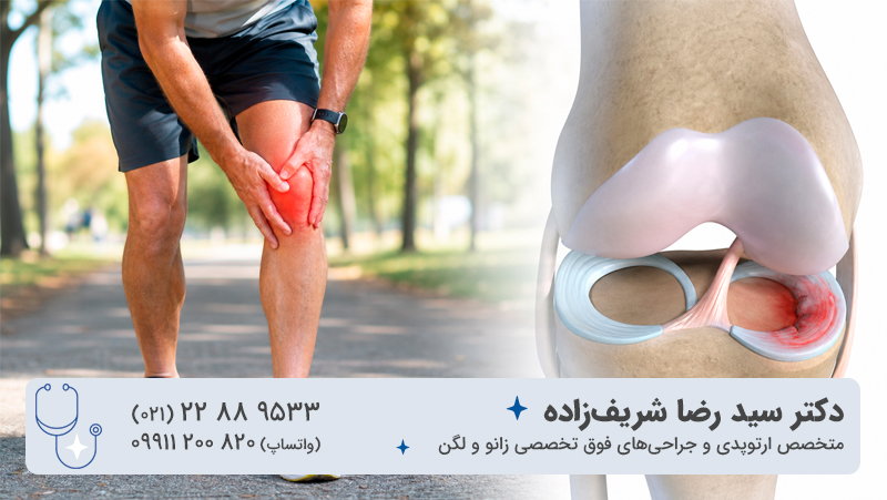 آسیب یا پارگی مینیسک؛ درد زانو پس از قدمزدن