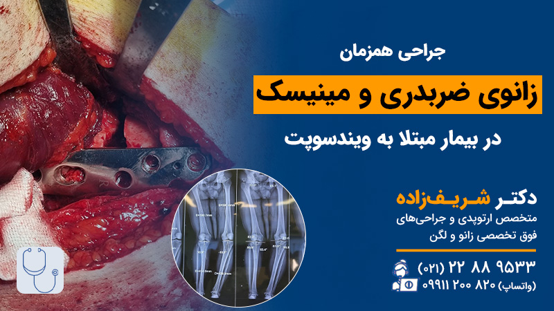 عمل جراحی زانو ضربدری