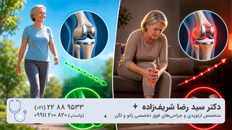 درد بعد از تعویض مفصل زانو؛ چه زمانی باید نگران شد؟