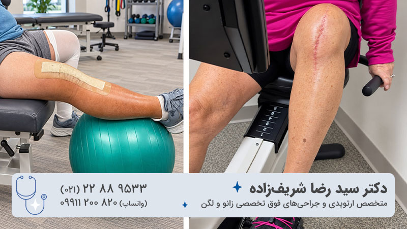 راههای تسکین و درمان درد بعد از عمل تعویض مفصل زانو
