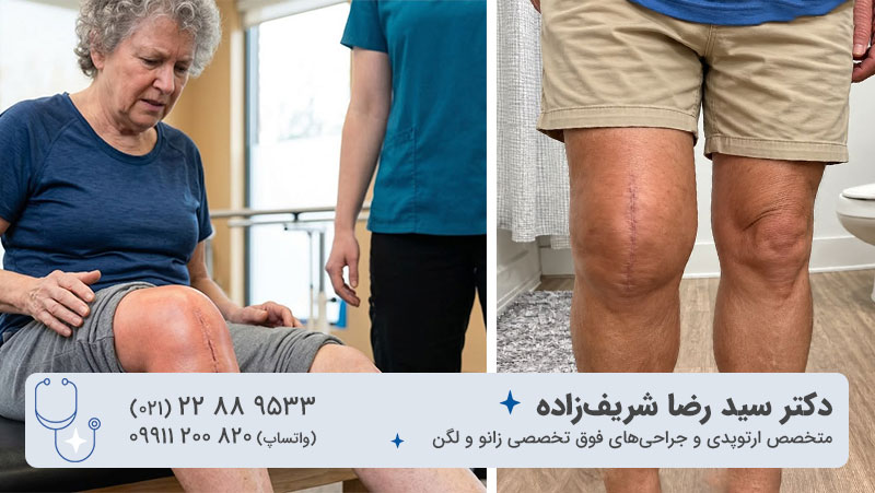 مدت زمان درد تعویض مفصل زانو تا چه موقع طبیعی است
